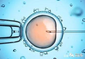 体外受精 IVF-ET